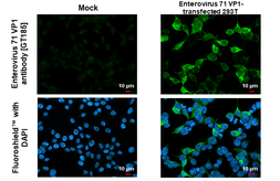 Anti-Enterovirus 71 VP1 antibody [GT185] used in Immunocytochemistry/ Immunofluorescence (ICC/IF). GTX633390